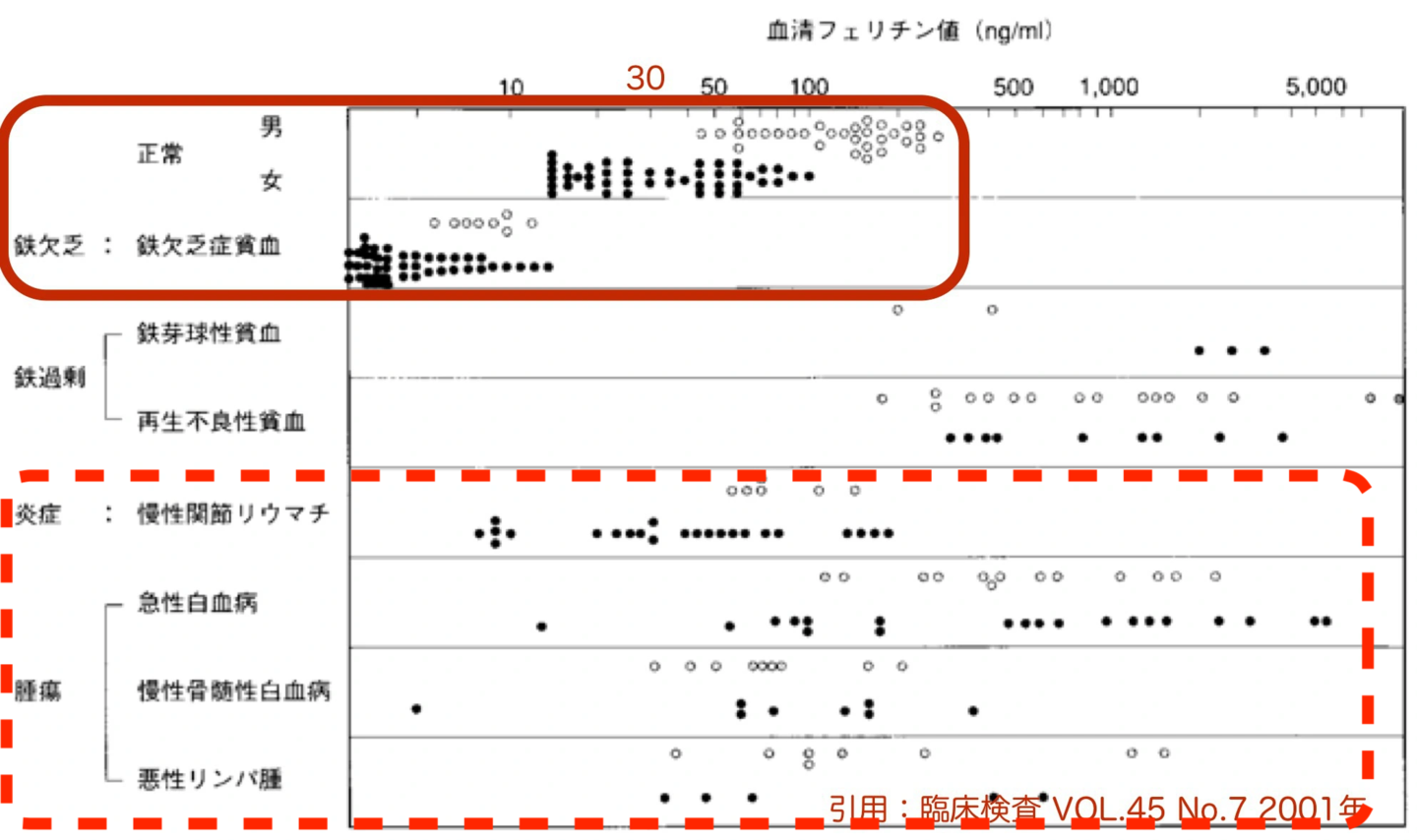 鉄過剰　基準値　フェリチン検査